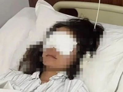 游客在景区遭水枪射伤眼，知情人：水枪购自景区，警方将鉴定